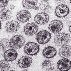 HIV Virus