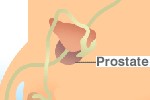 Prostate